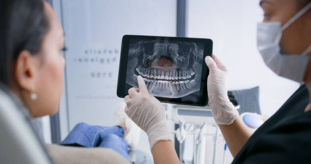 Licensed Dental Implants service in Marina, CA - Smile Center Dentistry